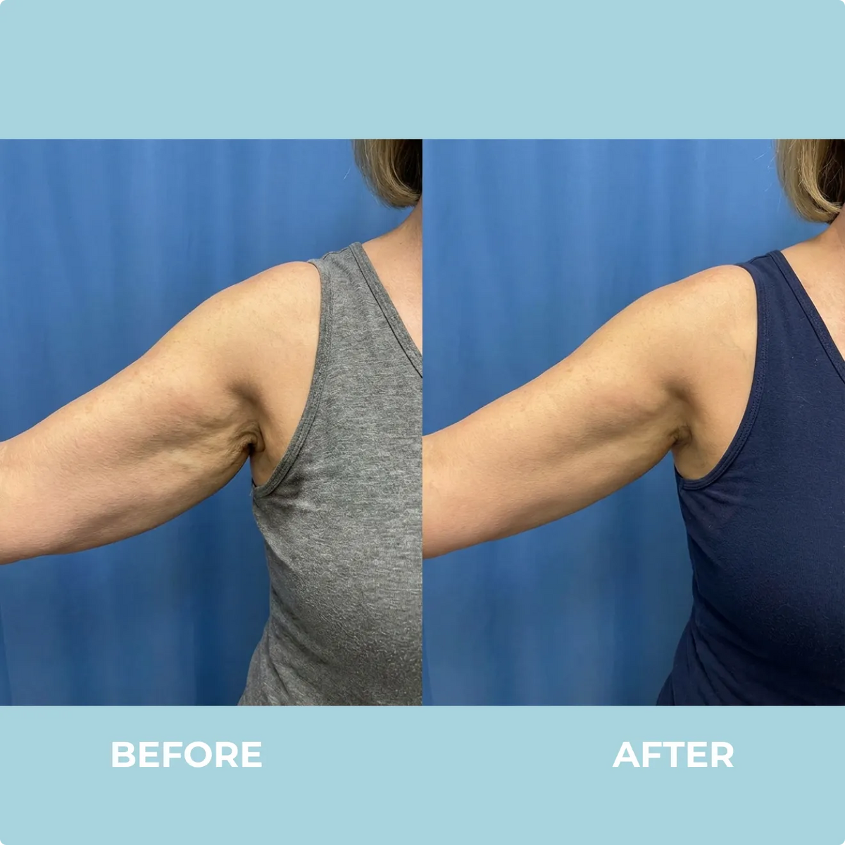 Masajeador Con Terapia de Luz Roja: Brazos, Rostro y Cuello